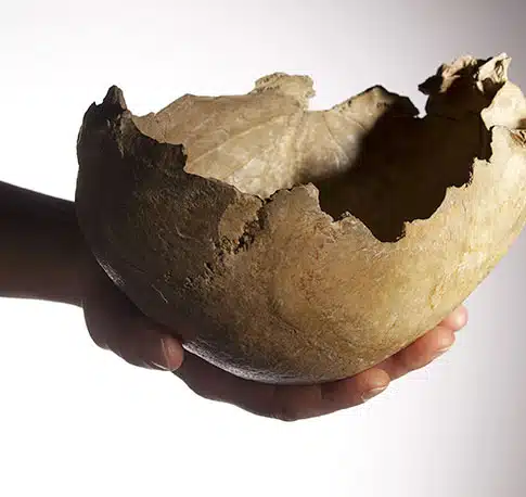 J’ai la tête qui tourne